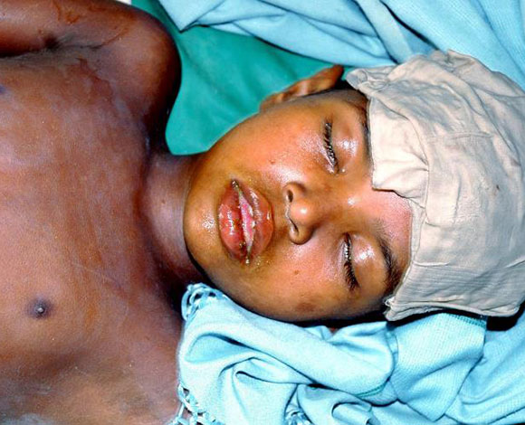 صور توعوية في يوم الصحة العالمي