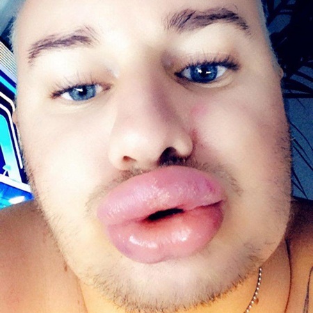 شاب يريد التحول إلى مارلين مونرو بعمليات التجميل