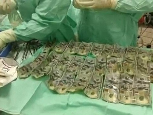 تبتلع 7000 دولار ثم تذهب للمستشفى .. فيديو