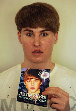 اشهر حالات عمليات التجميل الفاشلة للتشبه بالنجوم والنجمات