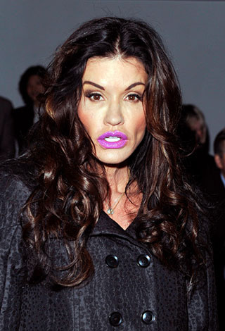 عندما تفشل عمليات تجميل النجوم... نتائج عكسية ستصدمك