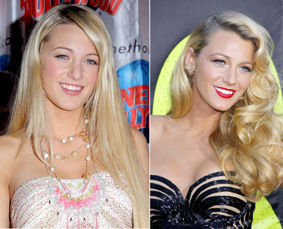 10 نجوم ونجمات باتوا أجمل مع جراحات التجميل... تعرف إليهم