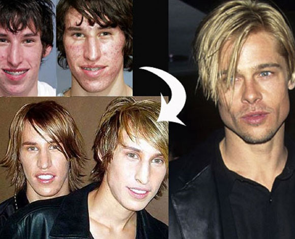 اشهر حالات عمليات التجميل الفاشلة للتشبه بالنجوم والنجمات