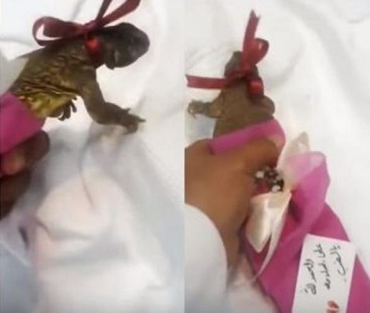 بالفيديو: سعودي يزور طفلًا في مستشفى ويهديه ضب!