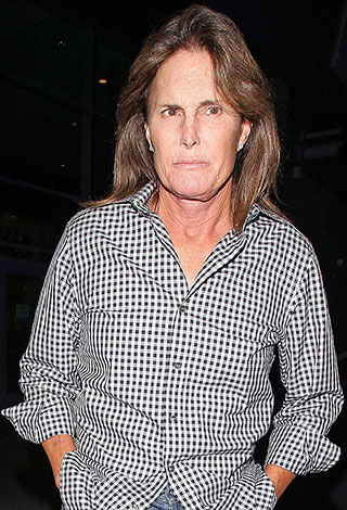 عندما تفشل عمليات تجميل النجوم... نتائج عكسية ستصدمك