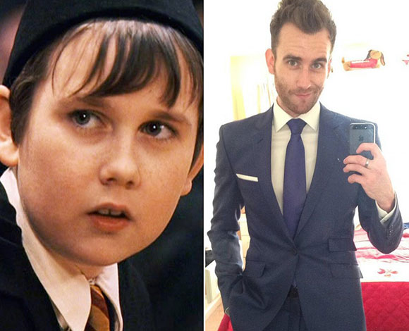 أبرز 10 نجوم تبدلت ملامحهم بشكل كبير عن مرحلة المراهقة