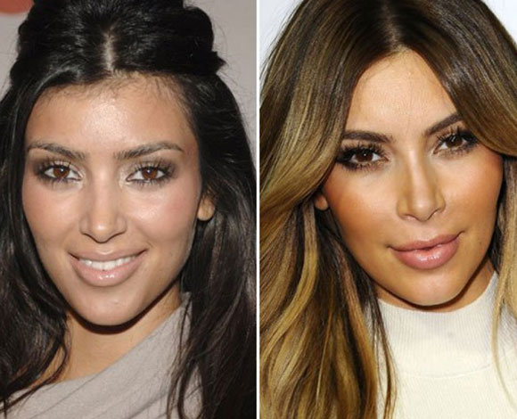 أبرز النجمات اللواتي ما يزلن ينكرن الخضوع لجراحات تجميل