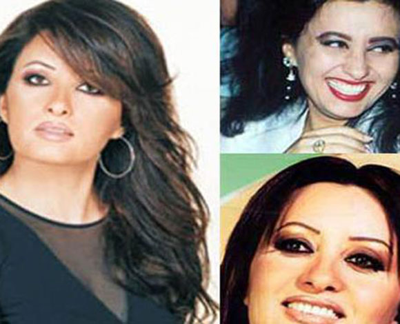 أنف النجمات قبل وبعد عمليات التجميل ... من مارلين مونرو إلى نانسي عجرم