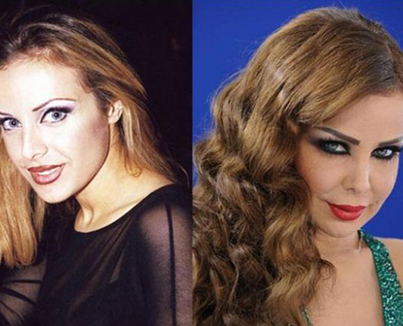 أنف النجمات قبل وبعد عمليات التجميل ... من مارلين مونرو إلى نانسي عجرم