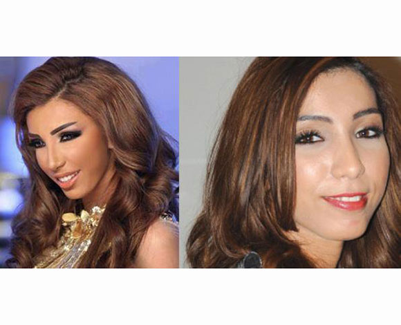 أنف النجمات قبل وبعد عمليات التجميل ... من مارلين مونرو إلى نانسي عجرم