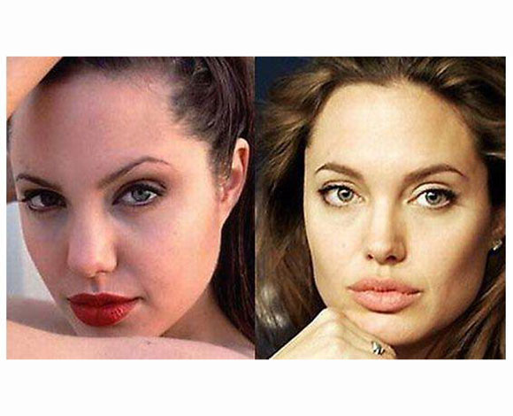 أنف النجمات قبل وبعد عمليات التجميل ... من مارلين مونرو إلى نانسي عجرم