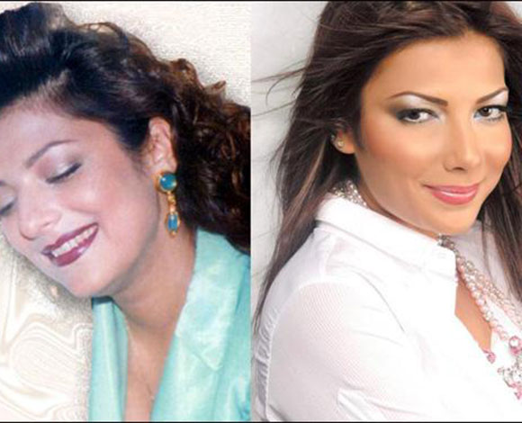 أنف النجمات قبل وبعد عمليات التجميل ... من مارلين مونرو إلى نانسي عجرم