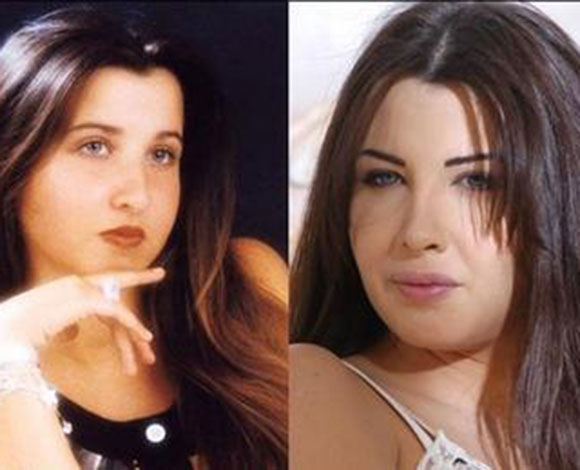 أنف النجمات قبل وبعد عمليات التجميل ... من مارلين مونرو إلى نانسي عجرم
