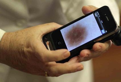 هل يمكن لتطبيق هاتف ذكي أن يكشف عن الإصابة بسرطان الجلد؟