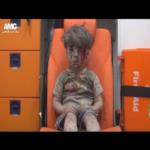 وفاة شقيق الطفل الذي أبكى العالم