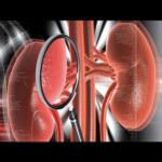 استئصال ورم بحجم 1800 غرام في أبو ظبي