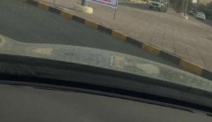 كويتية تعرض كُليتها للبيع ... بأغرب طريقة