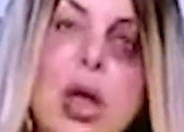 ما السبب وراء ظهور هذه المذيعة مضروبة على الهواء؟
