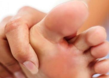 اعراض النقرس