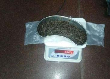 معدته لم تتأذ رغم 639 مسمار بها
