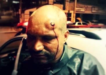 أطلقوا النار على رأسه .. ولم يستطيعوا قتله