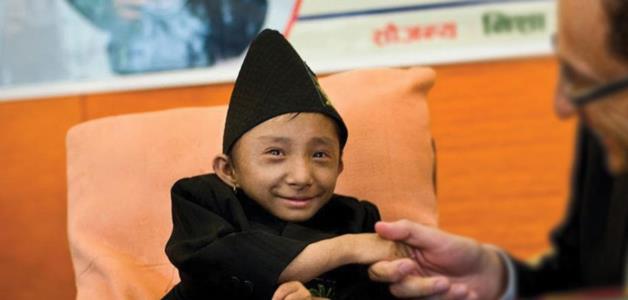 رحيل أقصر رجل متجول في العالم عن عمر 28 عامًا