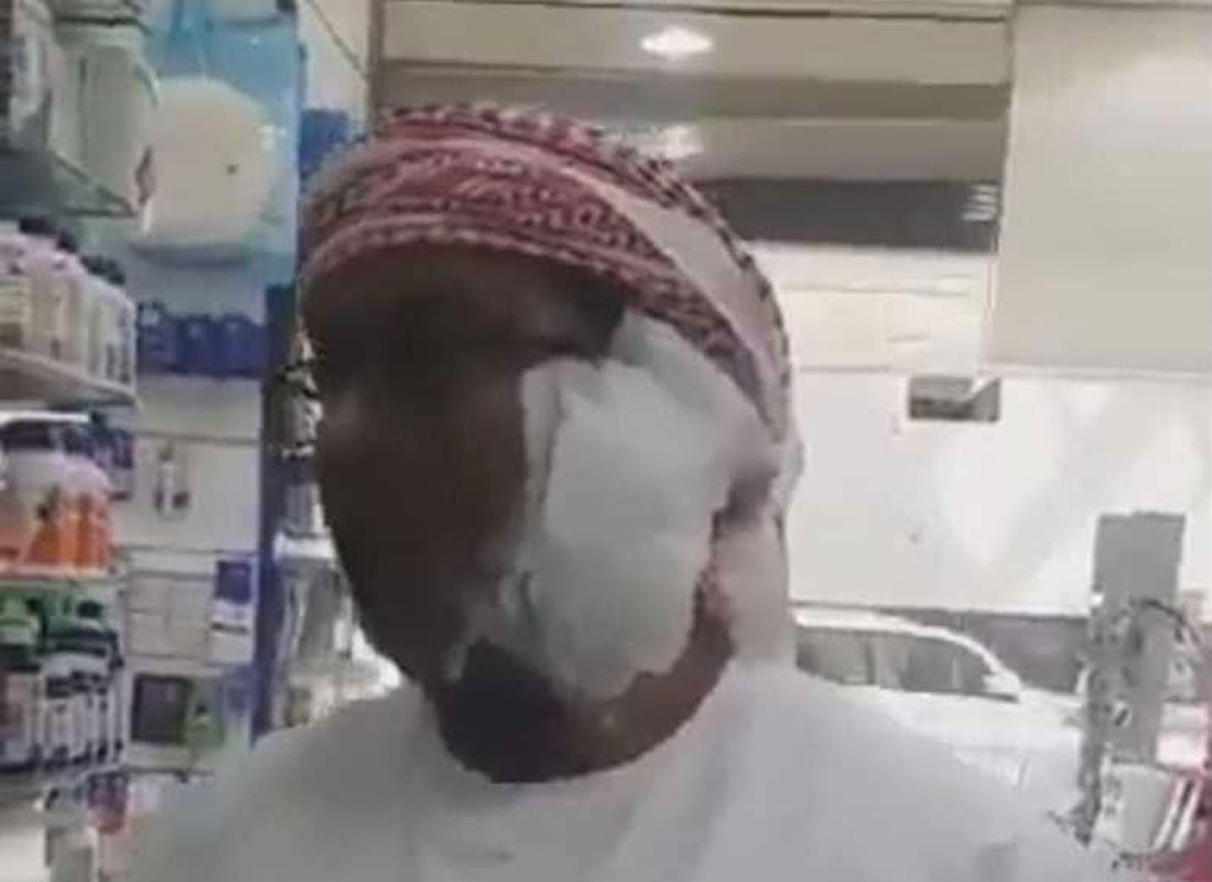 انفجار آيفون 8 في وج مواطن عربيّ