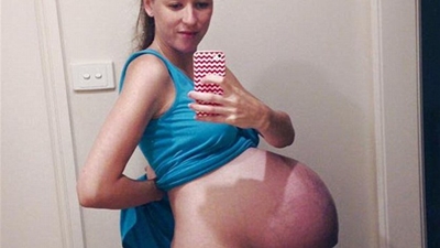 نشرت صورها وهي حامل على مواقع التواصل الإجتماعي .. لتندم على ذلك لاحقًا
